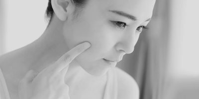 肌の状態を気にする女性